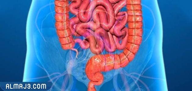 نصائح للتعايش مع القولون التقرحي