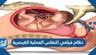 نظام فيافي للنفاس العملية القيصرية نظام فيافي للنفاس العملية القيصرية