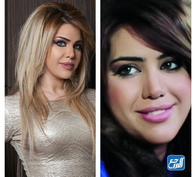 مروة راتب قبل وبعد