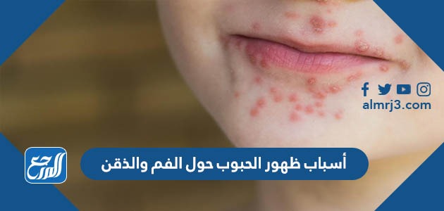 أسباب ظهور الحبوب حول الفم والذقن