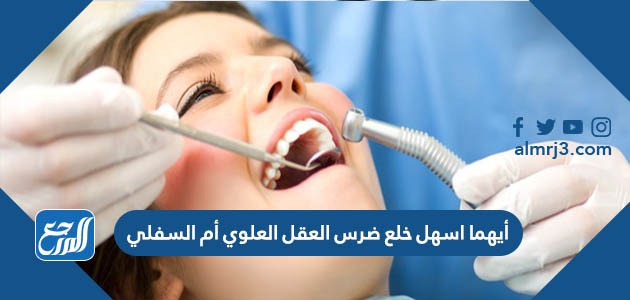 أيهما اسهل خلع ضرس العقل العلوي أم السفلي