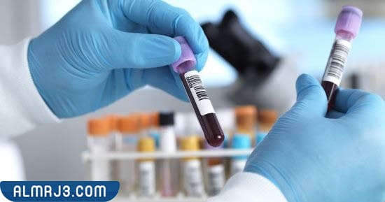 إرتفاع نسبة الهيموجلوبين عن المعدل الطبيعي