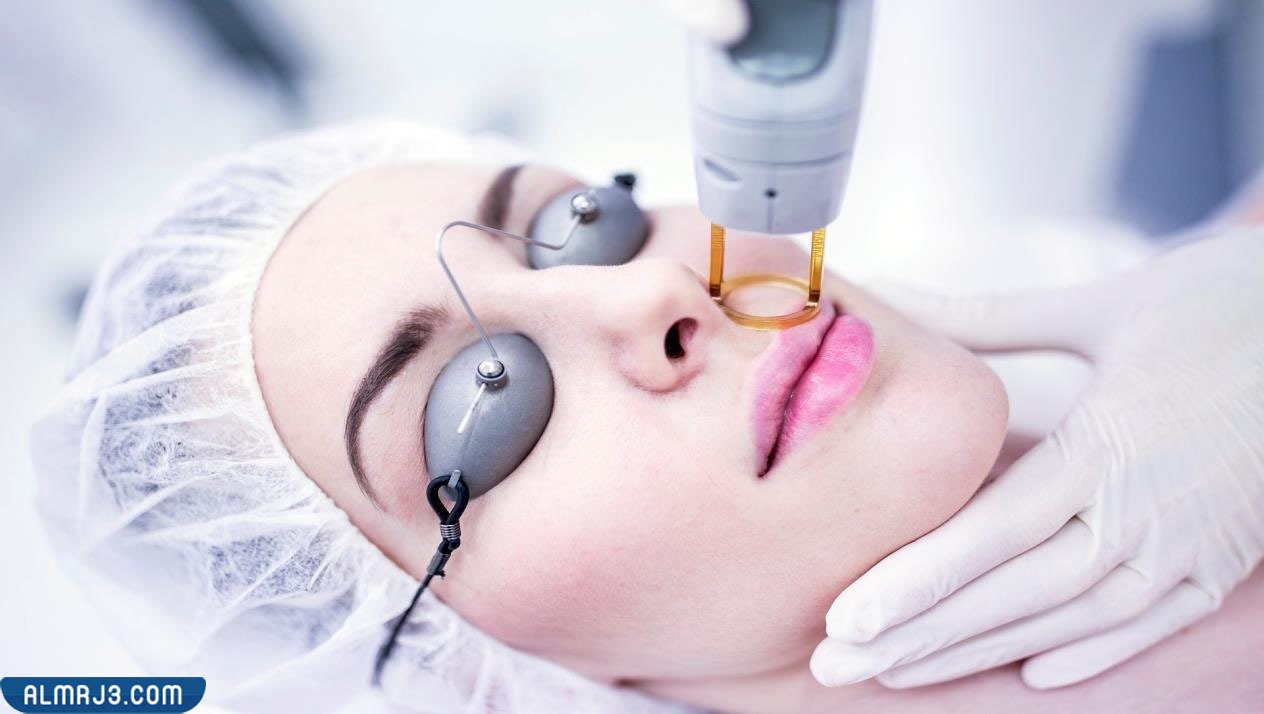 ما هي الإجراءات المتبعة بعد إزالة الشعر بالليزر