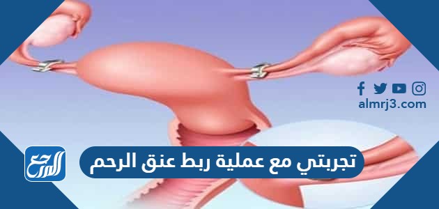 تجربتي مع عملية ربط عنق الرحم