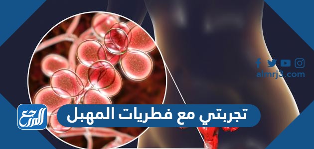 تجربتي مع فطريات المهبل