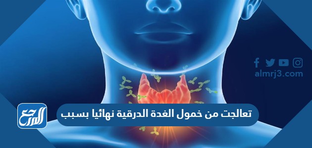 تعالجت من خمول الغدة الدرقية نهائيا بسبب