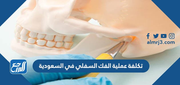 تكلفة عملية الفك السفلي في السعودية