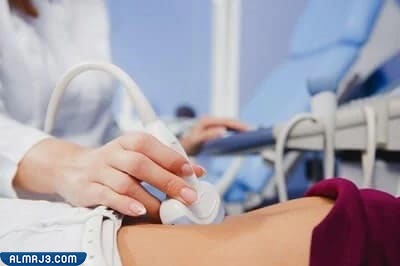 ثلاث خطوط والمولود ذكر