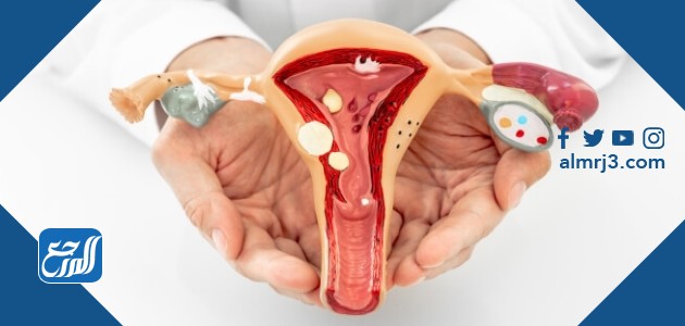 ربط عنق الرحم