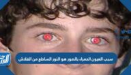 سبب العيون الحمراء بالصور هو النور الساطع من الفلاش