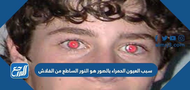 سبب العيون الحمراء