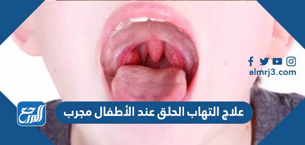 علاج التهاب الحلق عند الأطفال مجرب