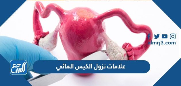 علامات نزول الكيس المائي