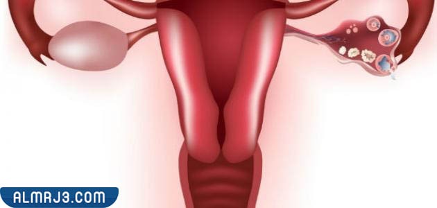 عوامل الخطر أثناء نزول الكيس المائي