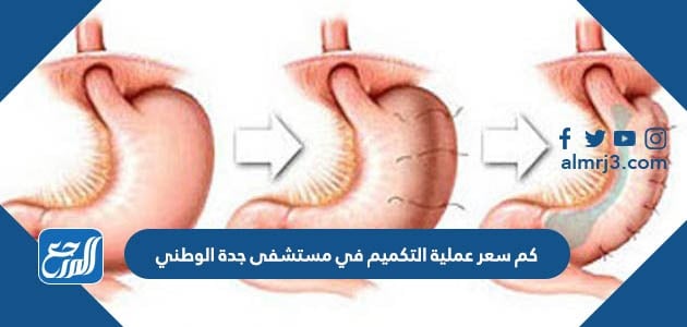 مستشفى جدة الوطني