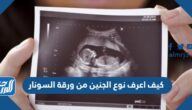 كيف اعرف نوع الجنين من ورقة السونار