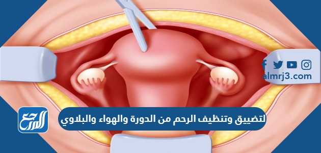 لتضييق وتنظيف الرحم من الدورة والهواء والبلاوي