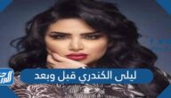 ليلى الكندري قبل وبعد
