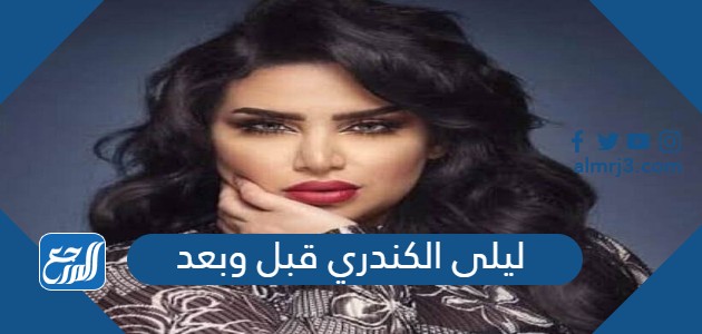 ليلى الكندري قبل وبعد