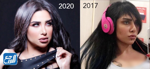 ليلى الكندري قبل وبعد