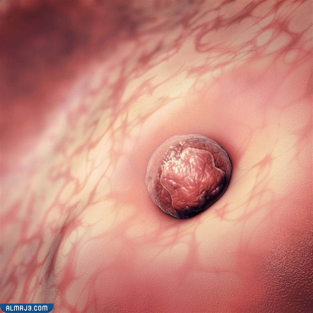 ما هو انغراس البويضة