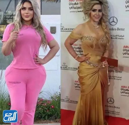 مروة راتب قبل وبعد