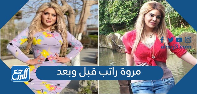 مروة راتب قبل وبعد