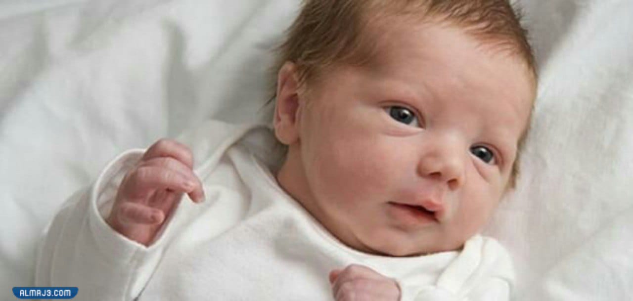 مشاكل العين التي يتعرض لها الرضيع 