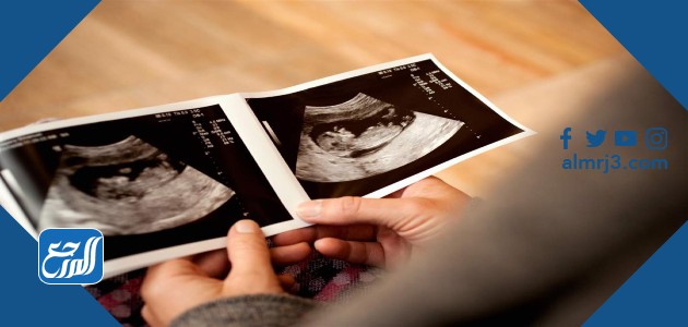 معرفة نوع الجنين