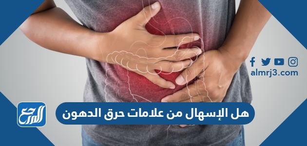 هل الإسهال من علامات حرق الدهون