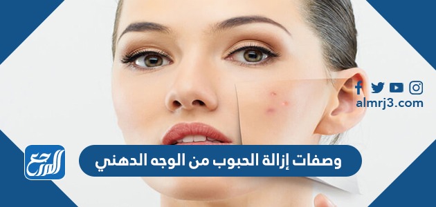 وصفات إزالة الحبوب من الوجه الدهني