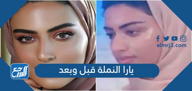 يارا النملة قبل وبعد