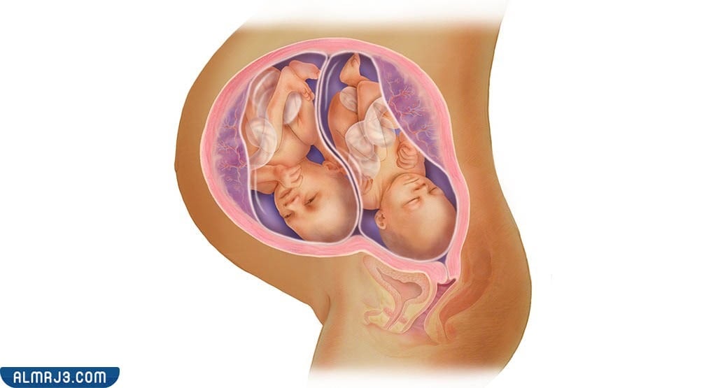 خطورة ولادة التوأم في الشهر الثامن