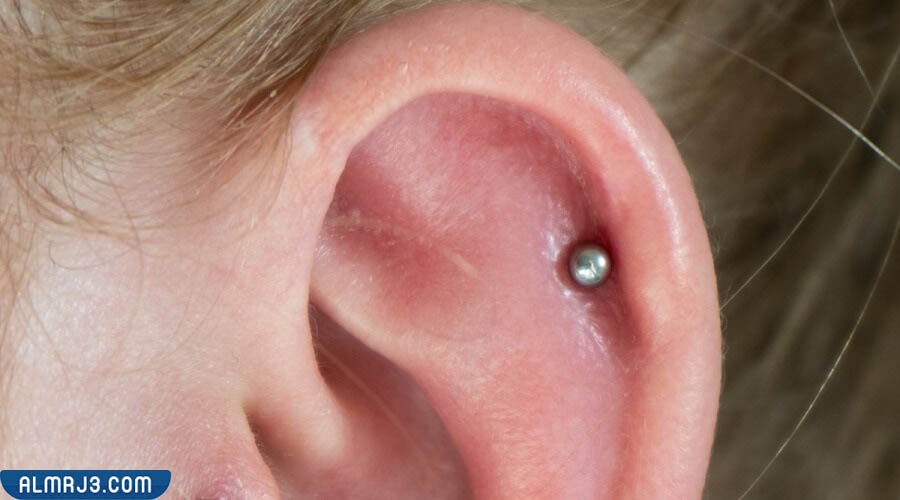 أسباب التهاب الأذن بعد إرتداء الحلق الذهب