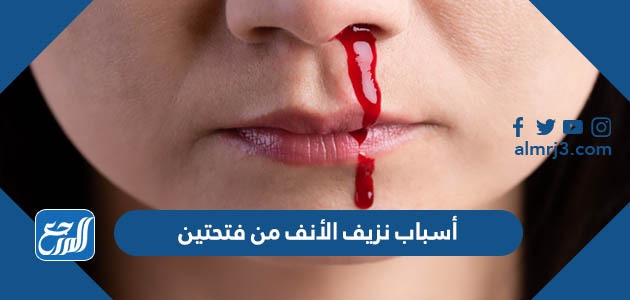 أسباب نزيف الأنف من فتحتين