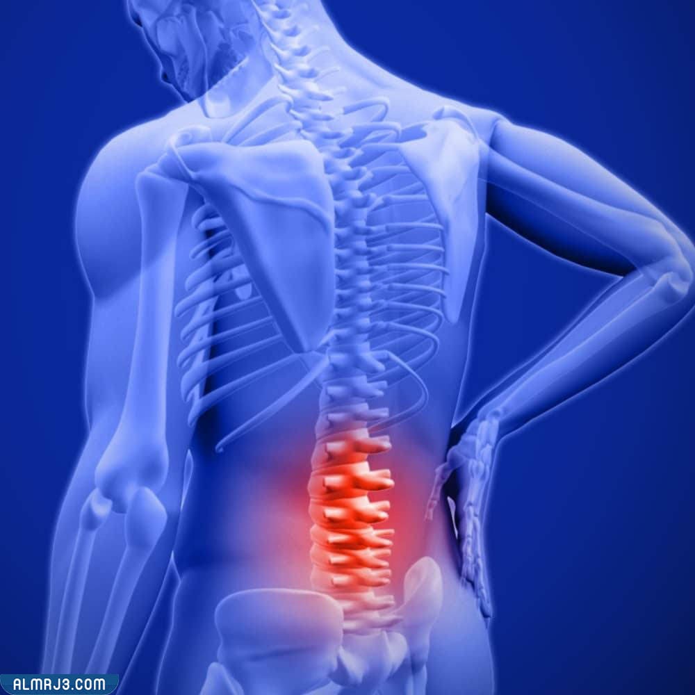 أعراض ألم الظهر الناتجة عن القولون 