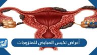 أعراض تكيس المبايض للمتزوجات وطرق علاجها