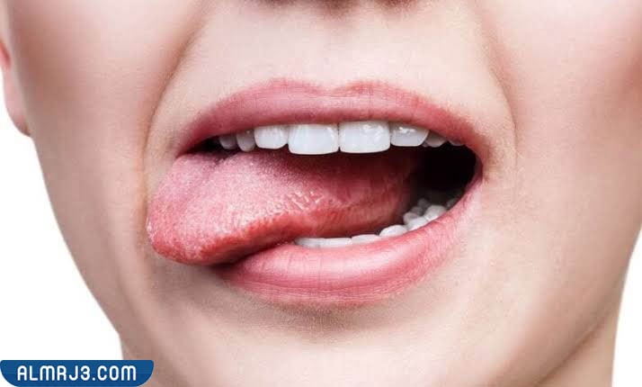 أعراض مرارة الفم