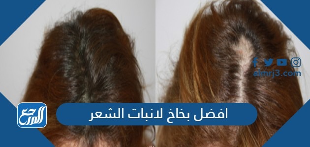 افضل بخاخ لانبات الشعر