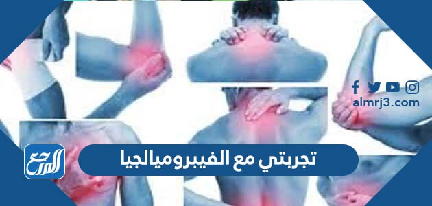 تجربتي مع الفيبروميالجيا