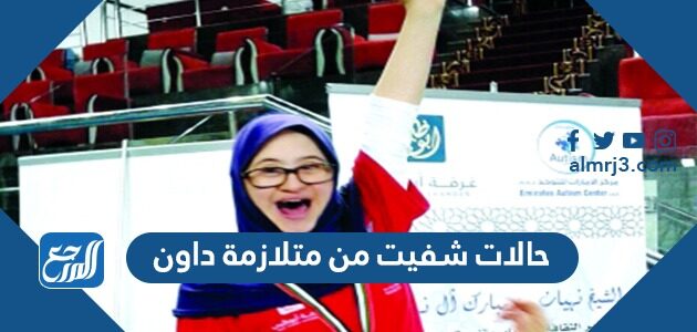 حالات شفيت من متلازمة داون
