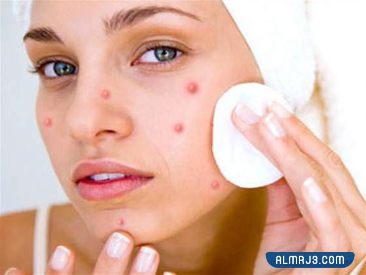 الحبوب عند الوجنتين