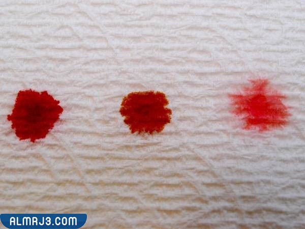 موعد نزول دم التعشيش