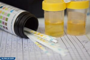 ما هو زلال البول