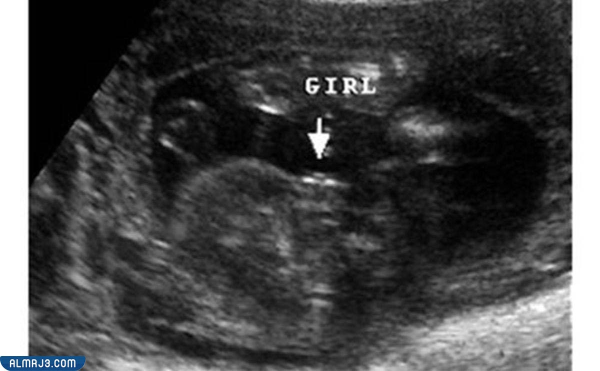 شكل الجنين الأنثى 