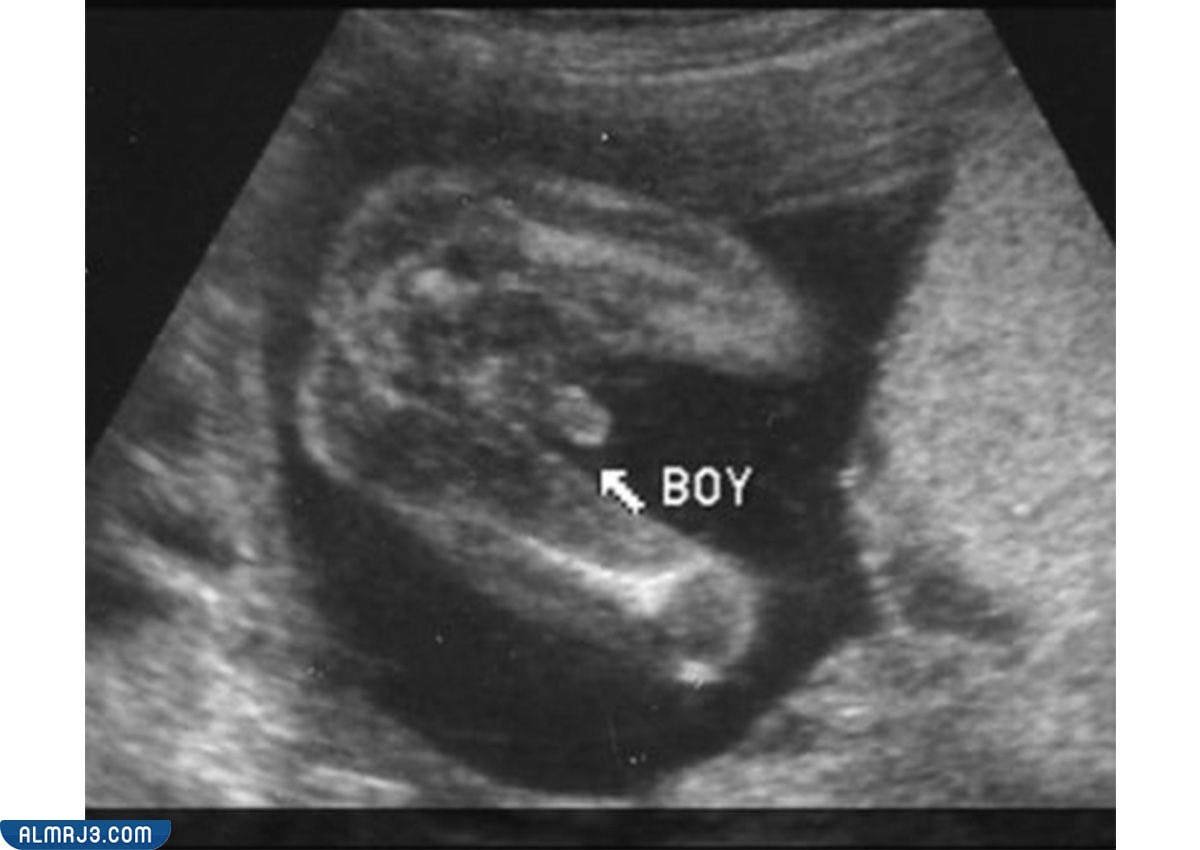 شكل الجنين الذكر
