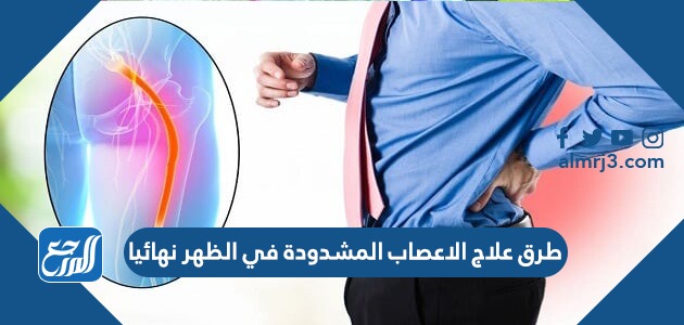 طرق علاج الاعصاب المشدودة في الظهر نهائيا