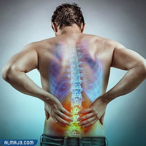 أسباب آلام الظهر