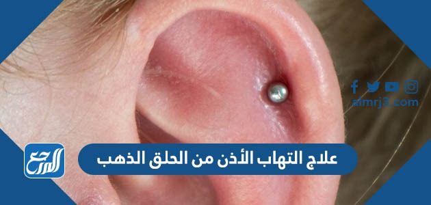 علاج التهاب الأذن من الحلق الذهب