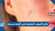 علاج الحبوب الصغيرة في الوجه بسرعة